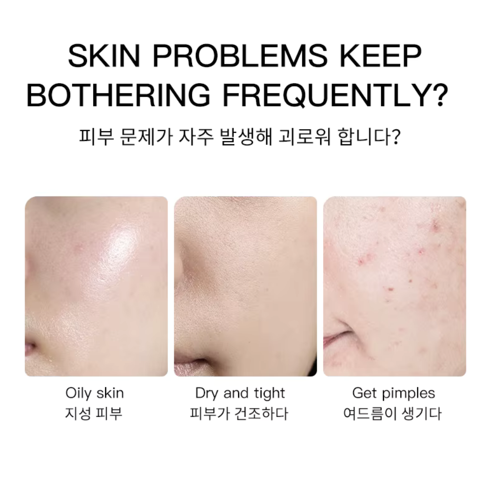 B5 Mask Series – Complete Skincare in One Box