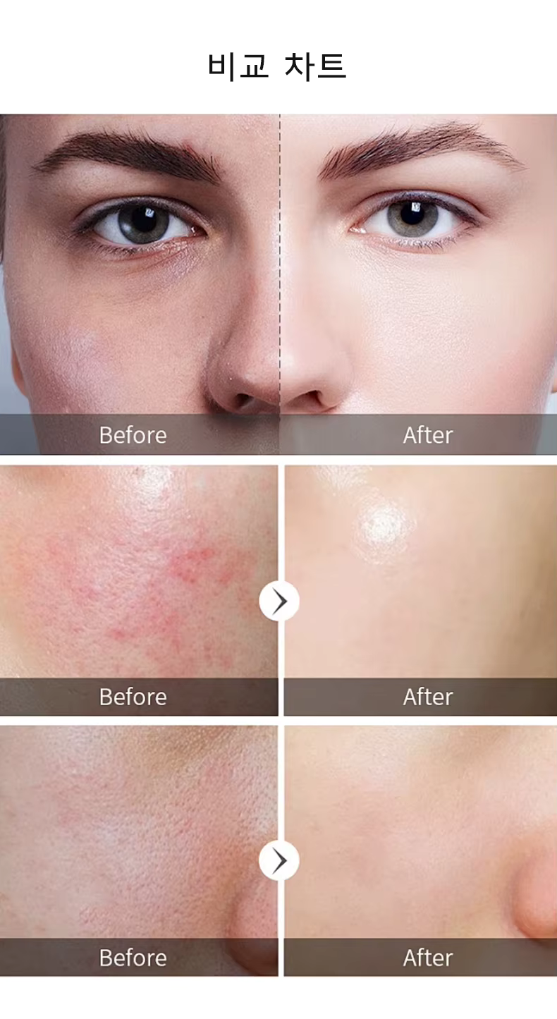 B5 EGF Collagen Mask